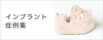 インプラント症例集
