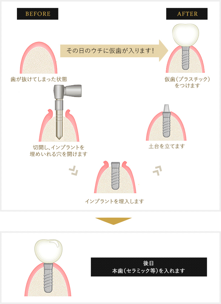 治療の流れ